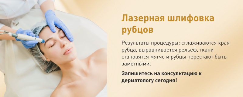 Удаление шрамов и рубцов лазером